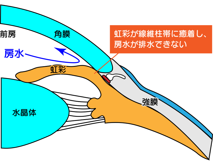 手術前