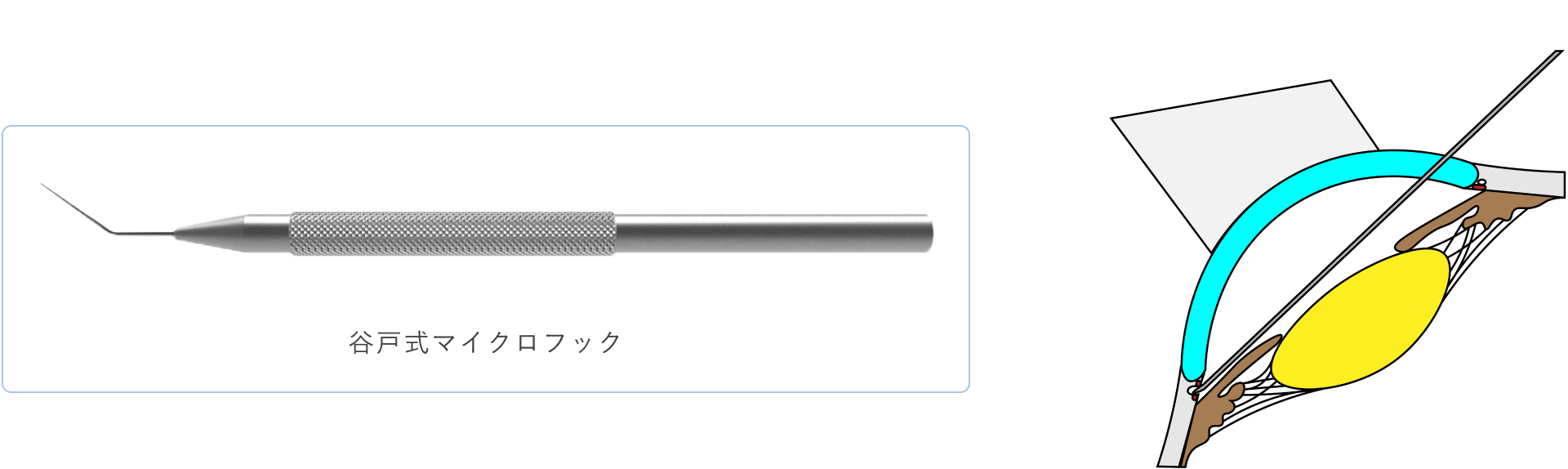 エクスプレス　図解