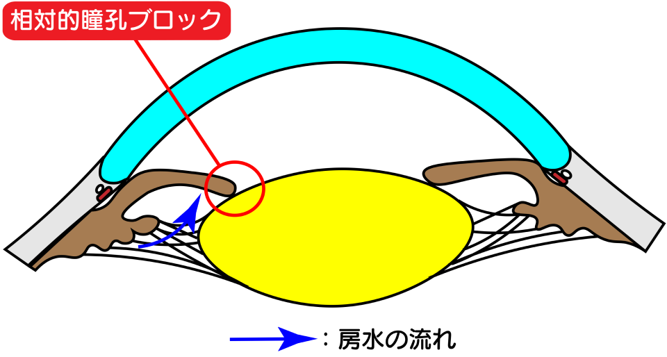 エクスプレス　図解