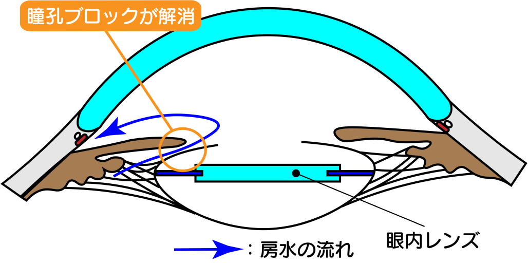 エクスプレス　図解