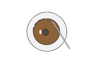 ハイドラスマイクロステント