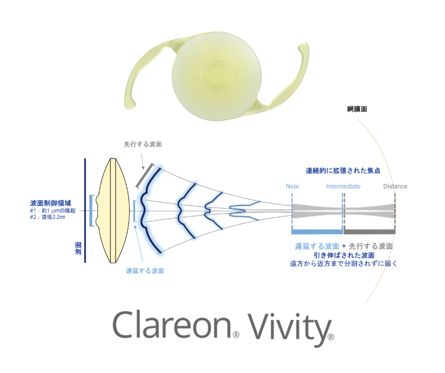 Clareon Vivity